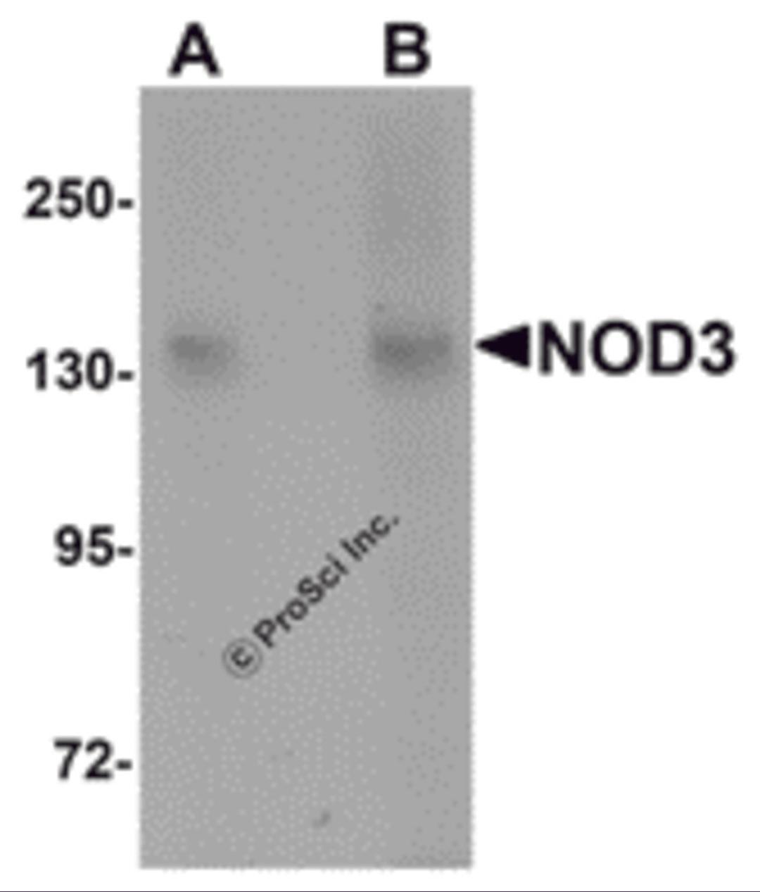 Western blot analysis of NOD3 in 3T3 cell lysate with NOD3 antibody at (A) 1 and (B) 2 μg/mL.