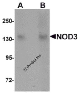 Western blot analysis of NOD3 in 3T3 cell lysate with NOD3 antibody at (A) 1 and (B) 2 μg/mL.