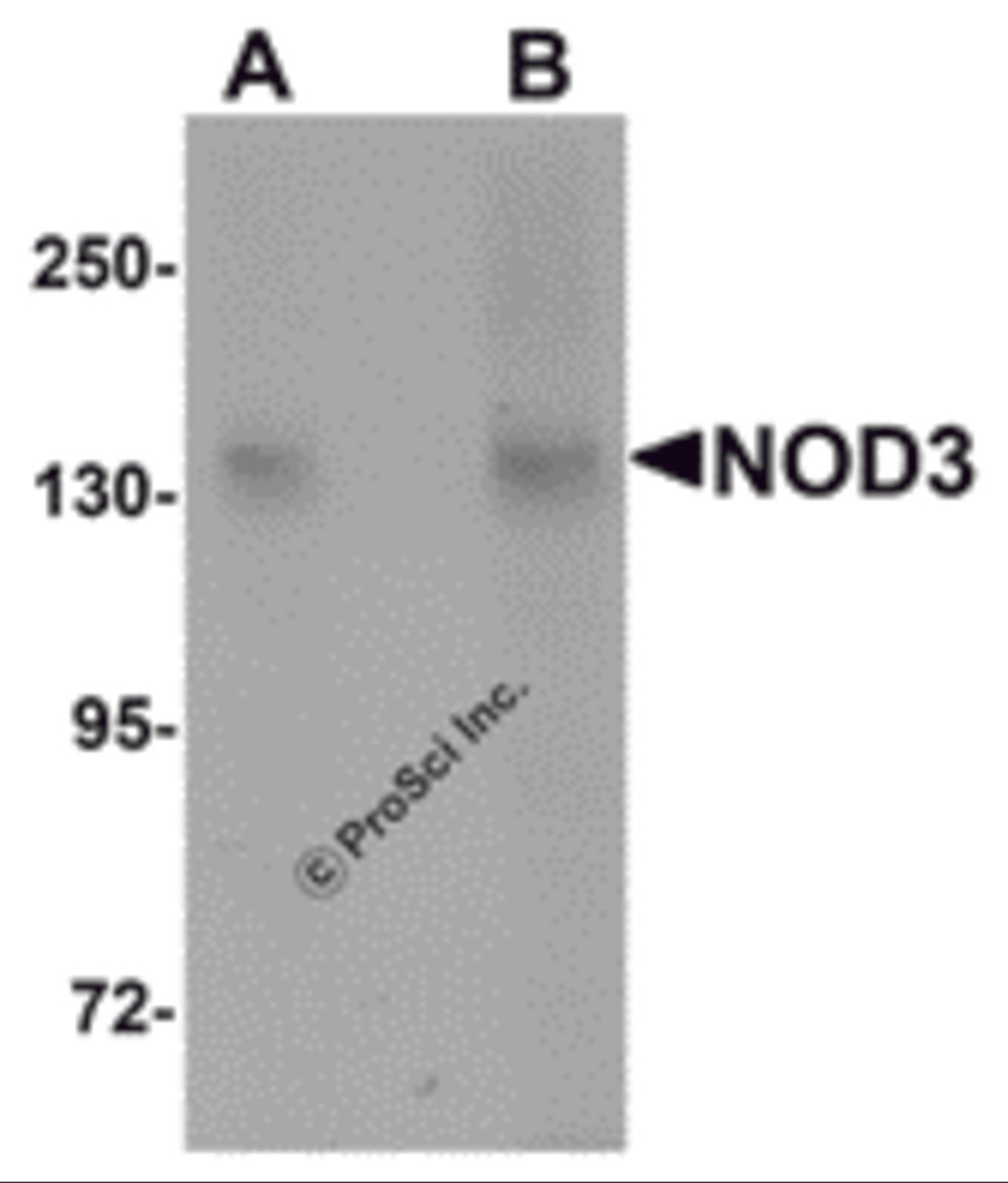Western blot analysis of NOD3 in 3T3 cell lysate with NOD3 antibody at (A) 1 and (B) 2 μg/mL.
