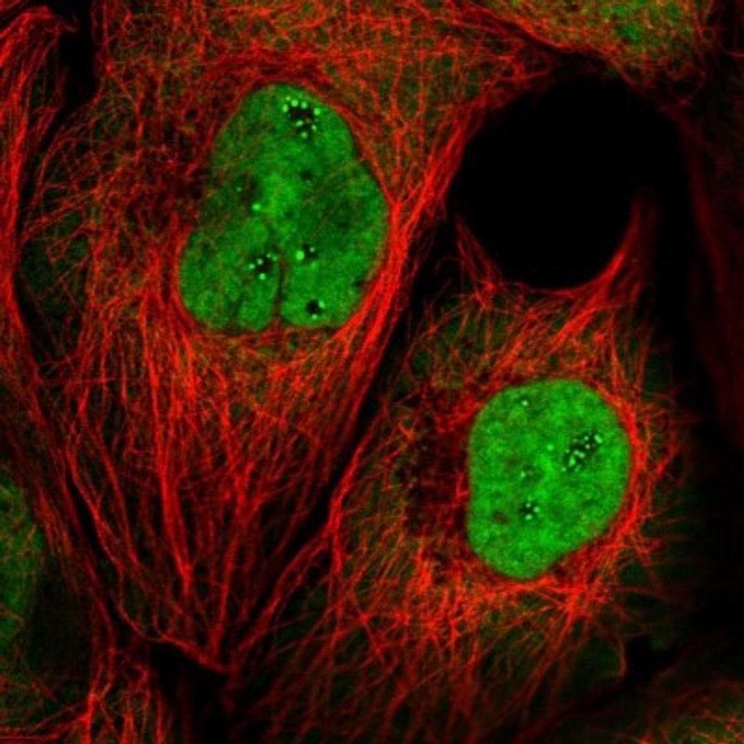 Immunocytochemistry/Immunofluorescence: U1A Antibody [NBP2-33465] - Immunofluorescent staining of human cell line A-431 shows positivity in nucleoli, cytoplasm & nucleus but excluded from the nucleoli.