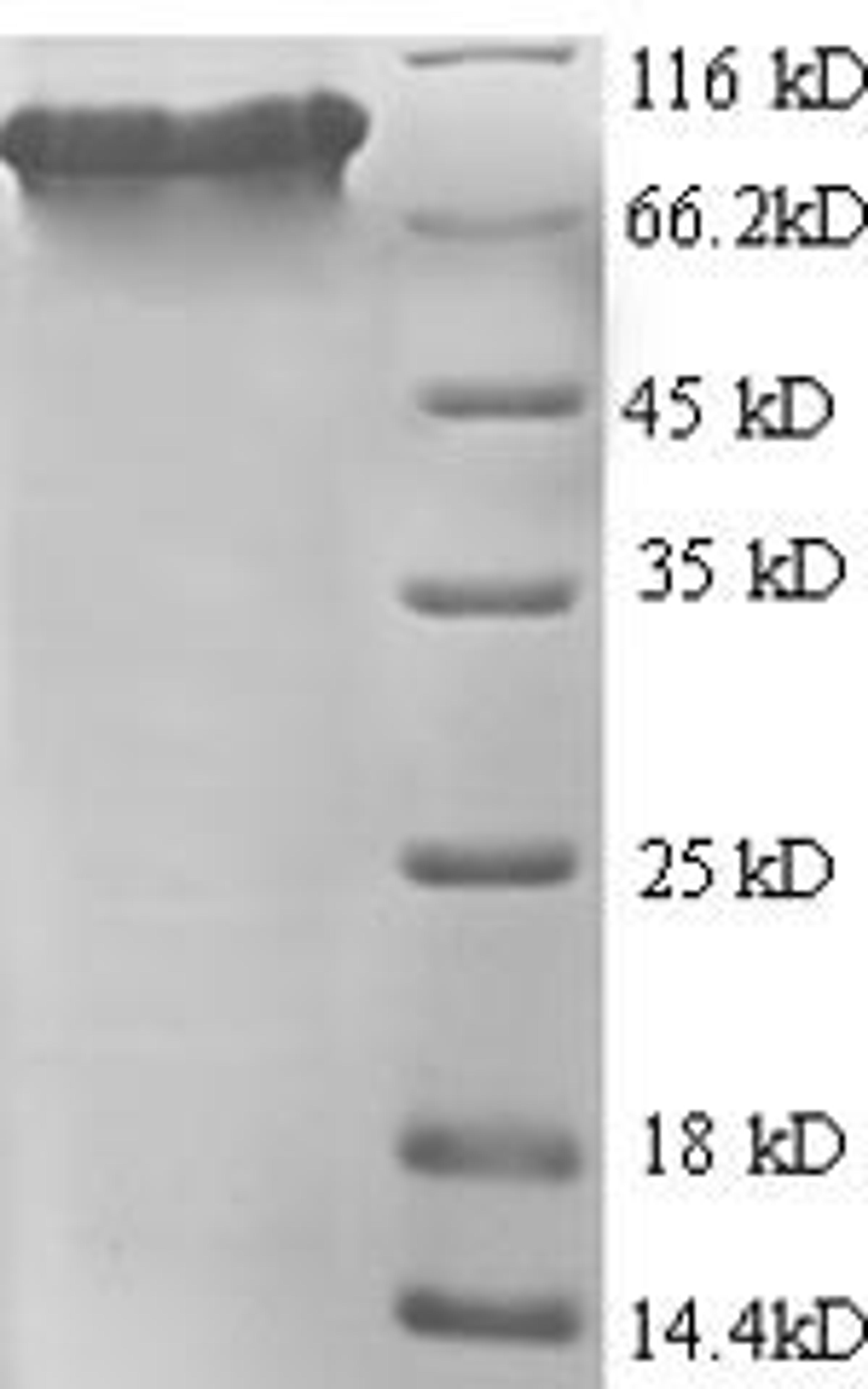 (Tris-Glycine gel) Discontinuous SDS-PAGE (reduced) with 5% enrichment gel and 15% separation gel.