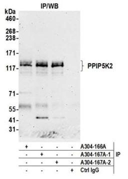 Detection of human PPIP5K2 by western blot of immunoprecipitates.