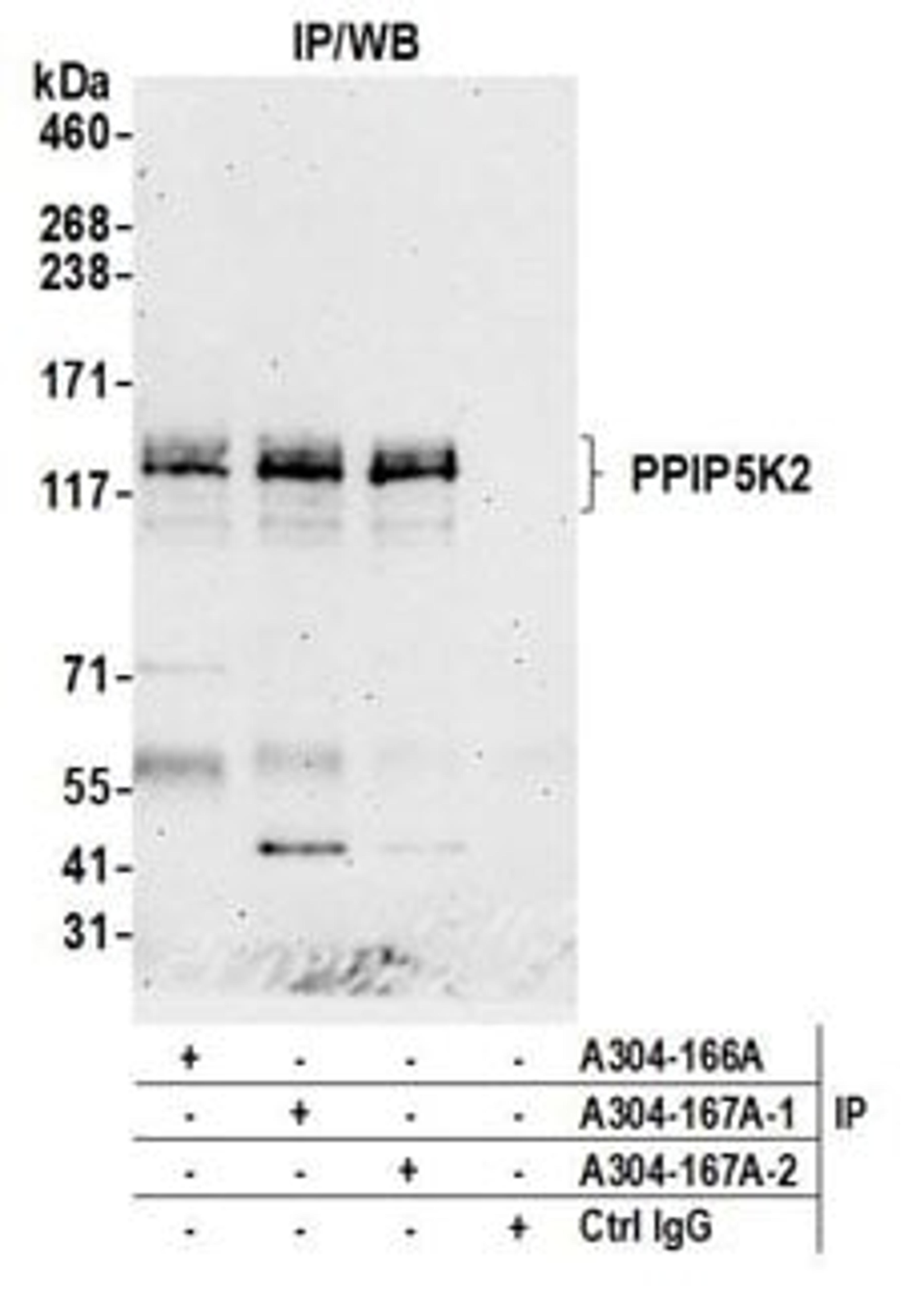 Detection of human PPIP5K2 by western blot of immunoprecipitates.