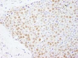 Detection of human FOXK2 by immunohistochemistry.