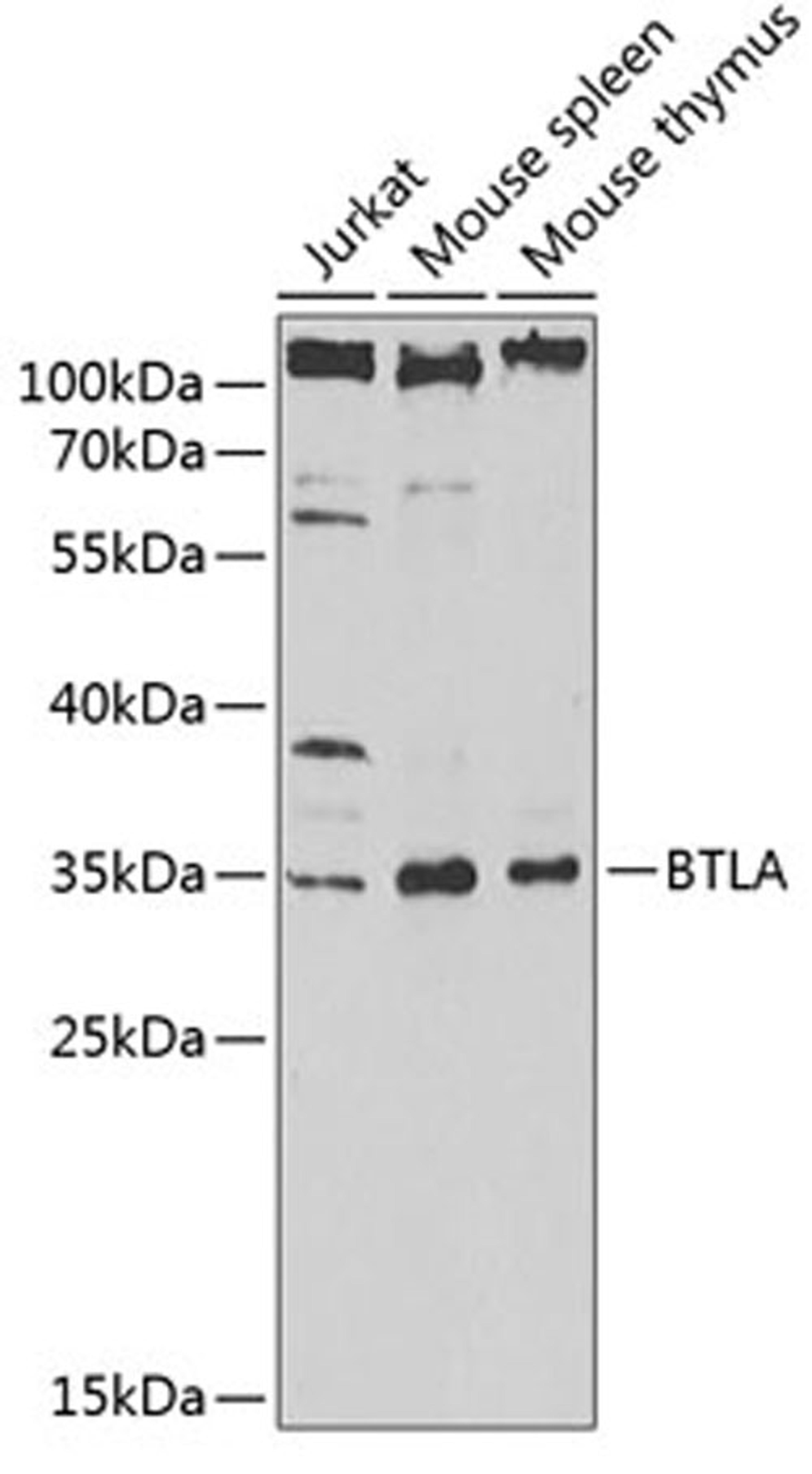 Western blot - BTLA antibody (A13449)