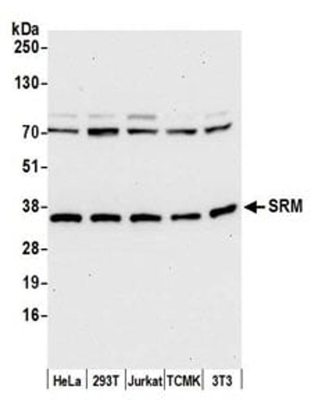 Detection of human and mouse SRM by western blot.