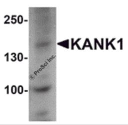 Western blot analysis of KANK1 in 3T3 cell lysate with KANK1 antibody at 1 μg/mL.