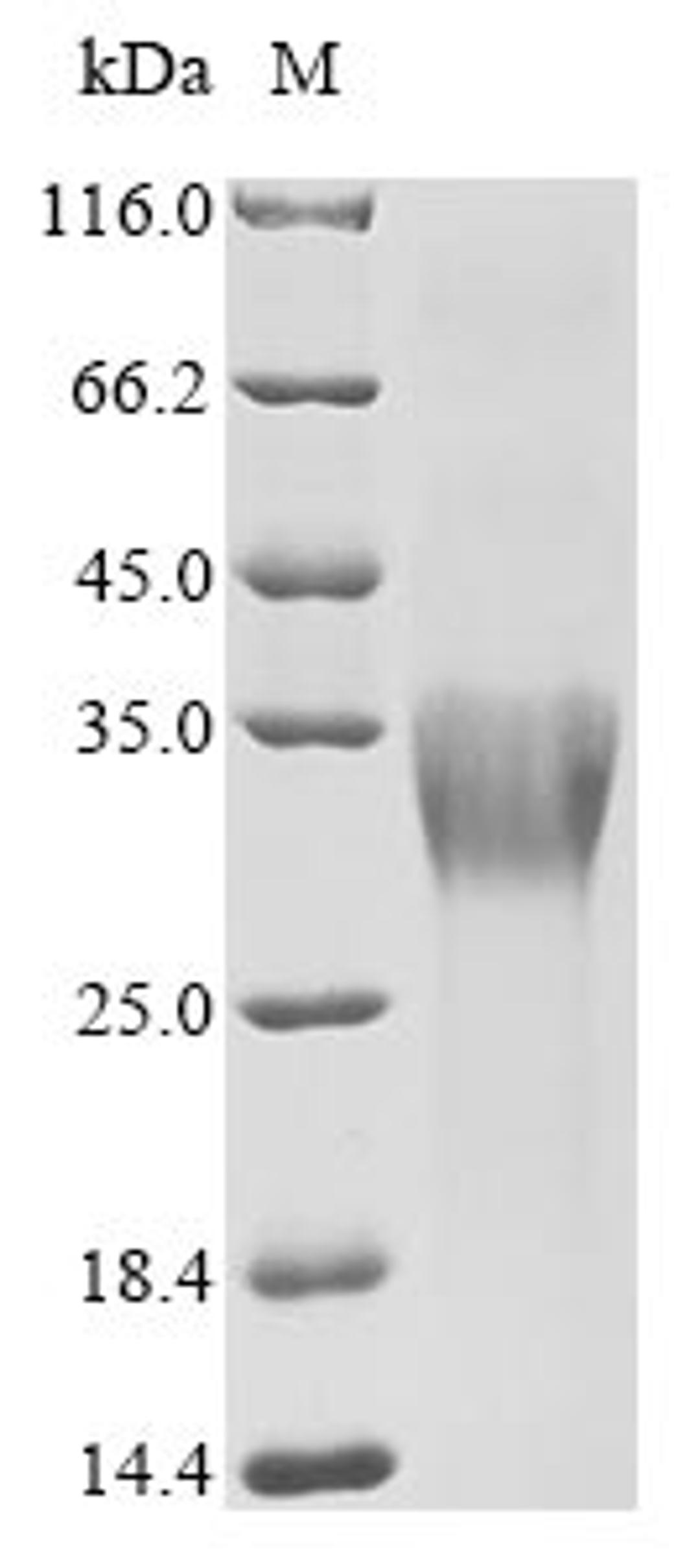 (Tris-Glycine gel) Discontinuous SDS-PAGE (reduced) with 5% enrichment gel and 15% separation gel.