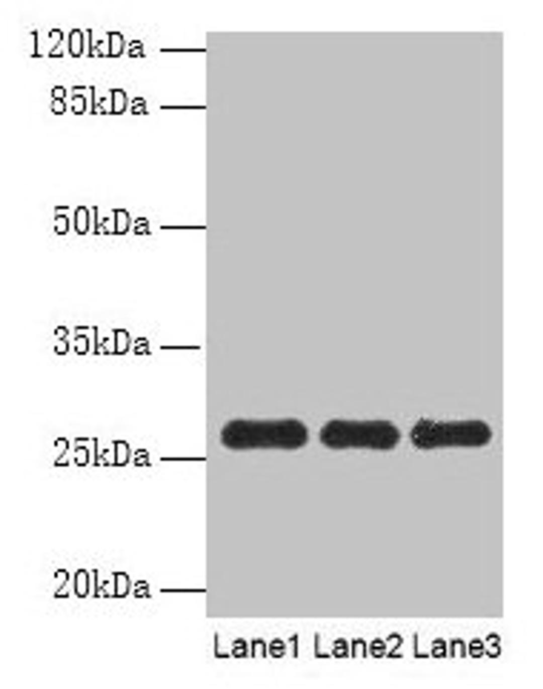 Western blot. All lanes: PEX11B antibody at 10µg/ml. Lane 1: 293T whole cell lysate. Lane 2: Hela whole cell lysate. Lane 3: K562 whole cell lysate. Secondary. Goat polyclonal to rabbit IgG at 1/10000 dilution. Predicted band size: 29, 27 kDa. Observed band size: 27 kDa