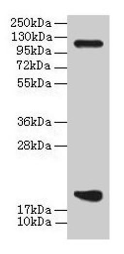 Western blot. All lanes: PPIH antibody at 8µg/ml + THP-1 whole cell lysate. Secondary. Goat polyclonal to rabbit IgG at 1/10000 dilution. Predicted band size: 20, 15 kDa. Observed band size: 20 kDa