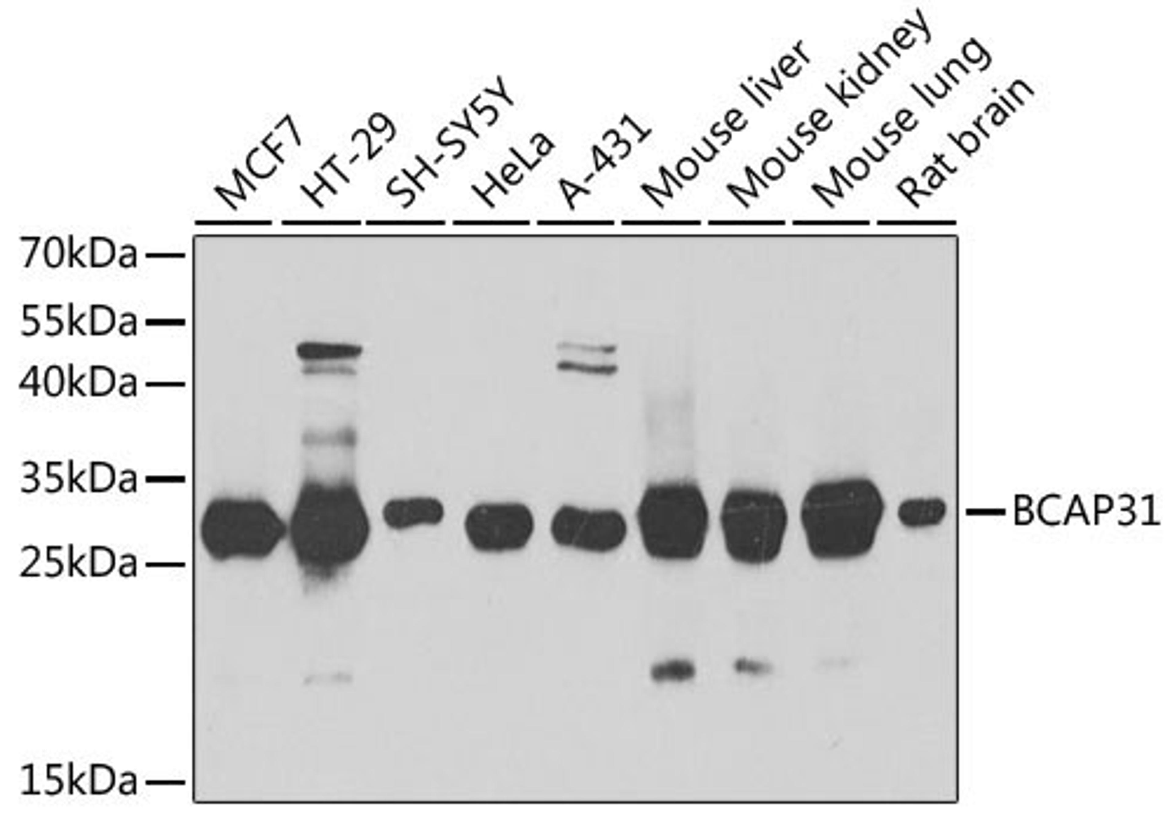 Western blot - BCAP31 antibody (A7056)