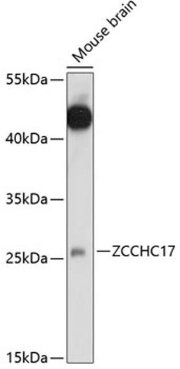 Western blot - ZCCHC17 antibody (A14891)