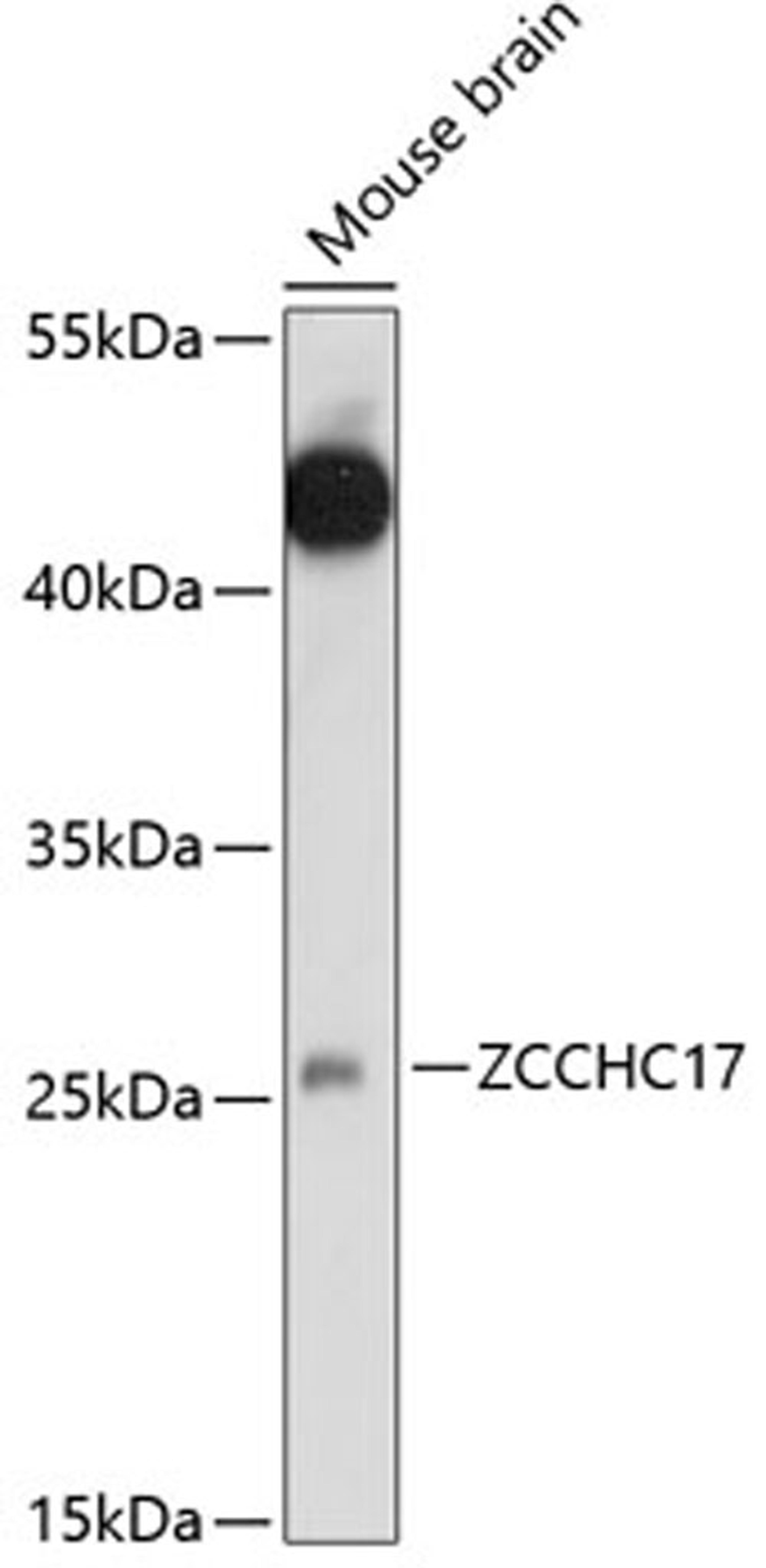 Western blot - ZCCHC17 antibody (A14891)