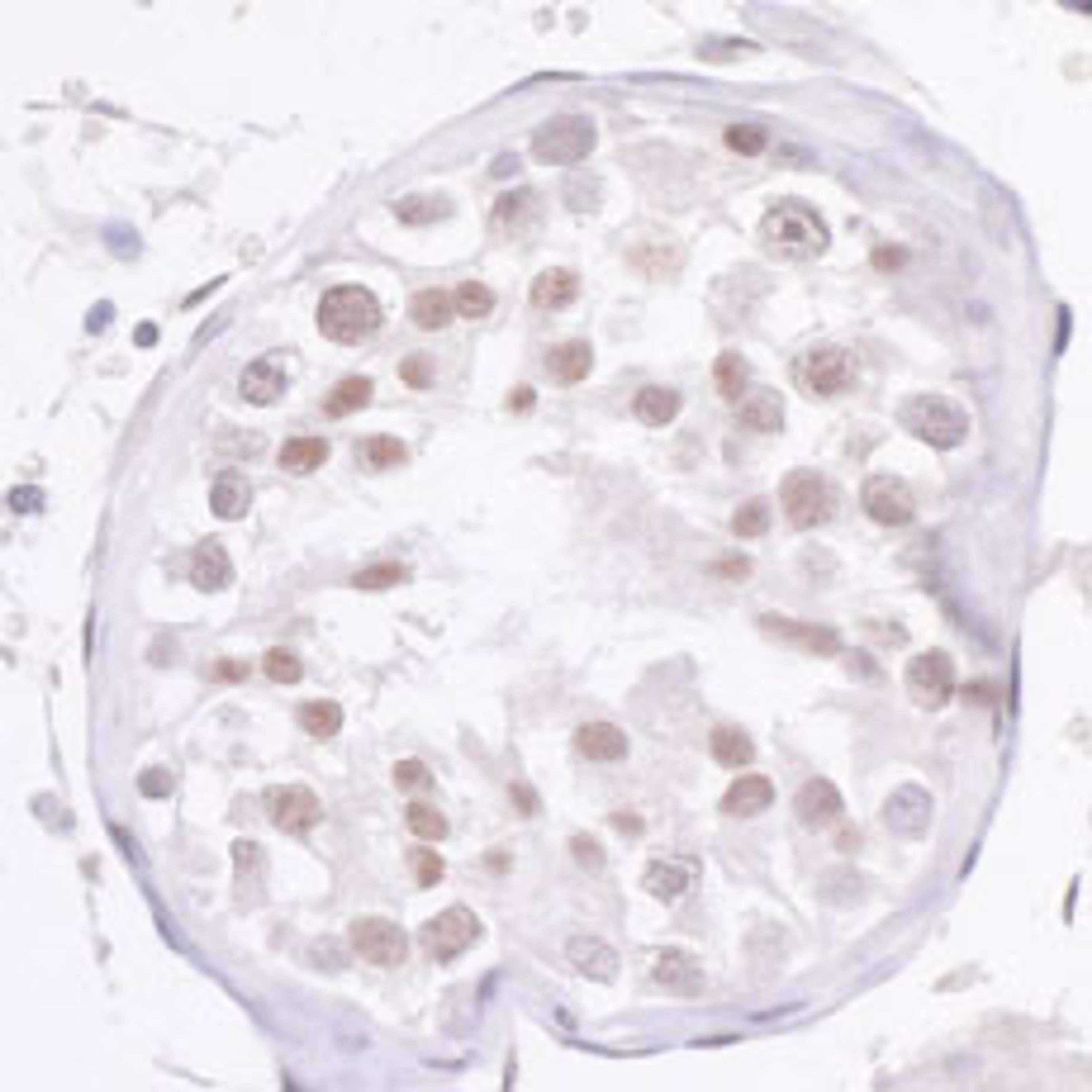 Detection of human NCOA2/ SRC2 by immunohistochemistry.