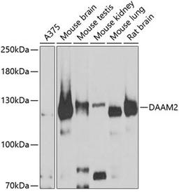 Western blot - DAAM2 antibody (A7463)