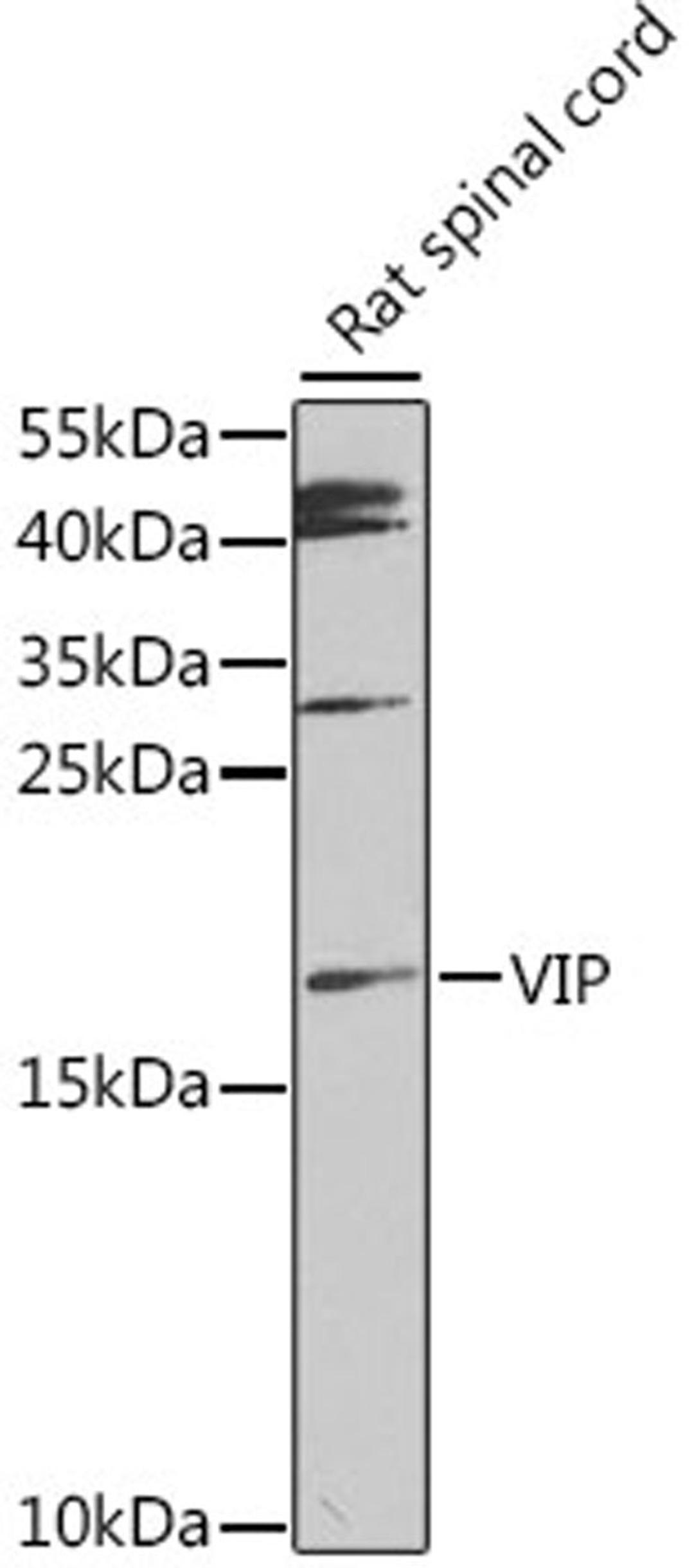 Western blot - VIP antibody (A12531)