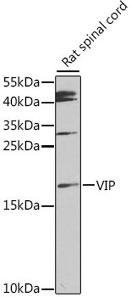 Western blot - VIP antibody (A12531)