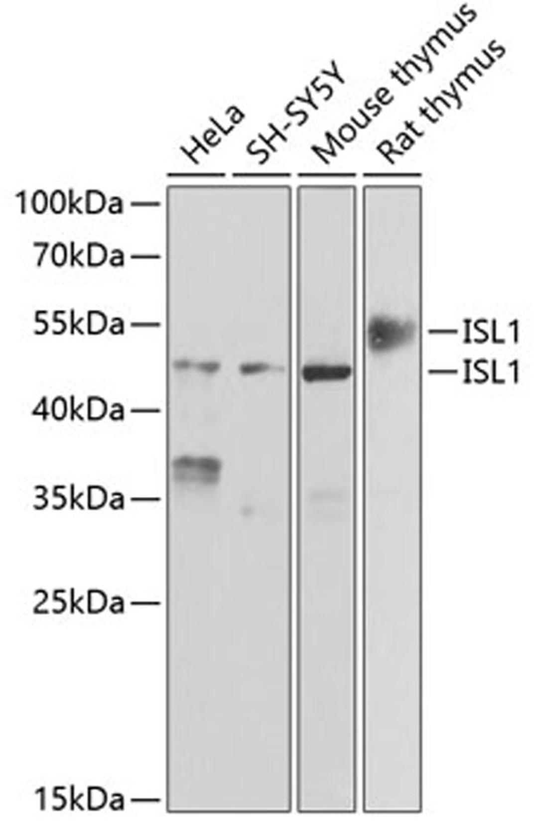 Western blot - ISL1 antibody (A6383)