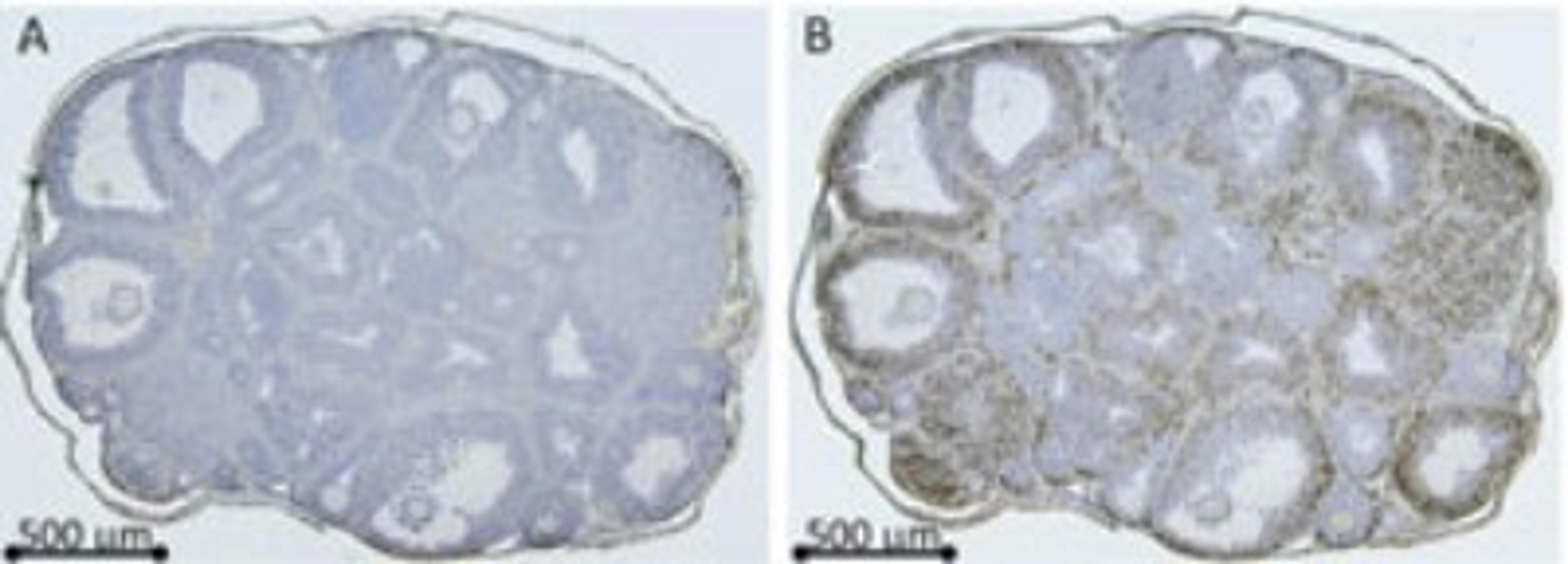 Immunohistochemistry-Paraffin: Rhox8 Antibody [NBP2-23671] - Immunolocalization of Rhox-8 protein in mice. Serial ovarian sections from eCG primed mice, after 8 h hCG-treated mice were incubated with either preimmune serum (1:250 dilution, A) or Rhox-8 antibody (1:2500 dilution, B).