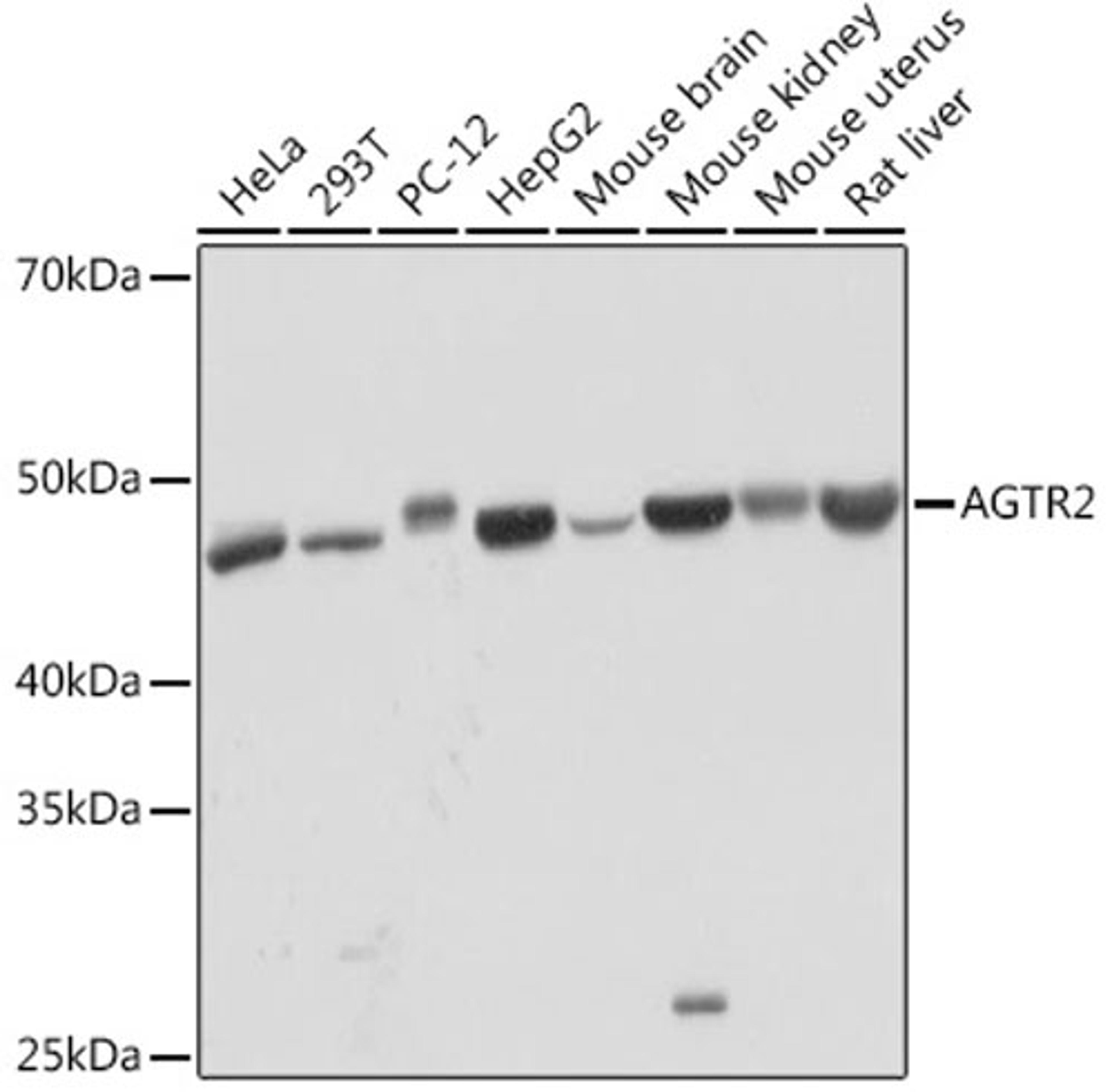 Western blot - AGTR2 Rabbit mAb (A3654)