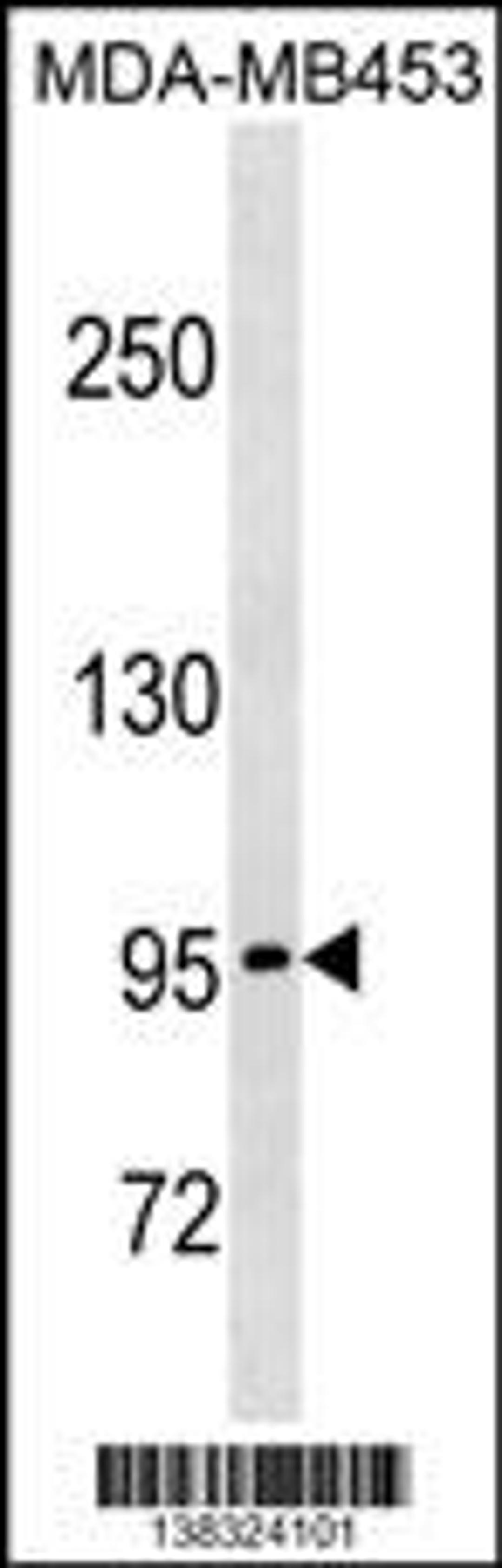 Western blot analysis in MDA-MB453 cell line lysates (35ug/lane).