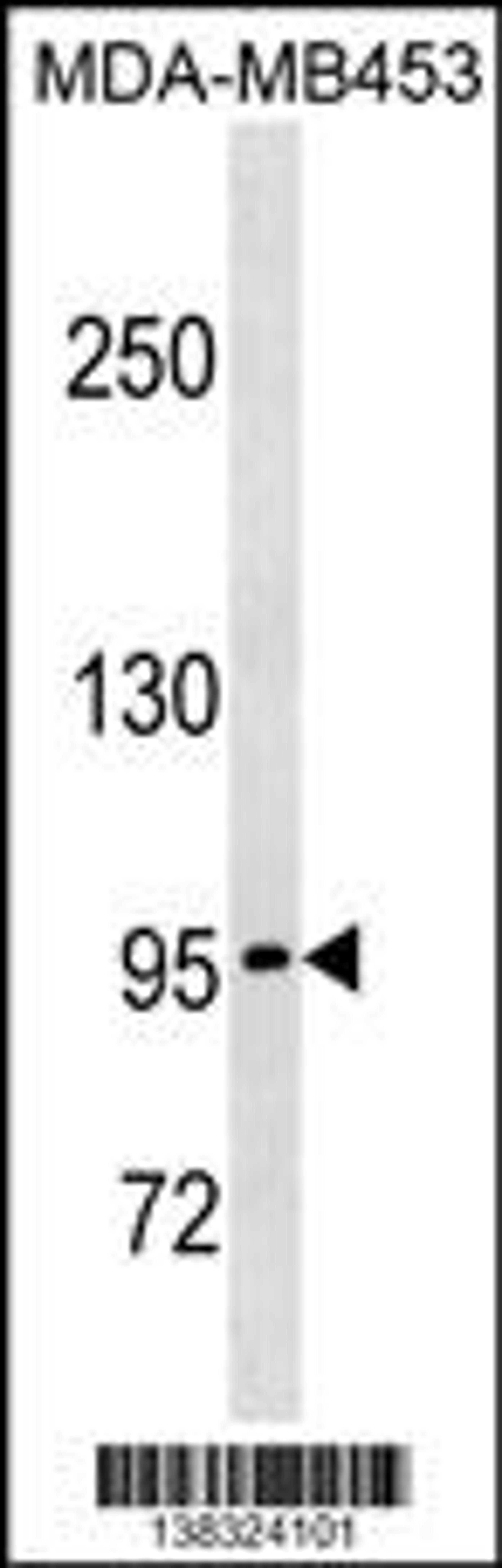 Western blot analysis in MDA-MB453 cell line lysates (35ug/lane).