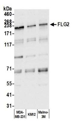 Detection of human FLG2 by WB.