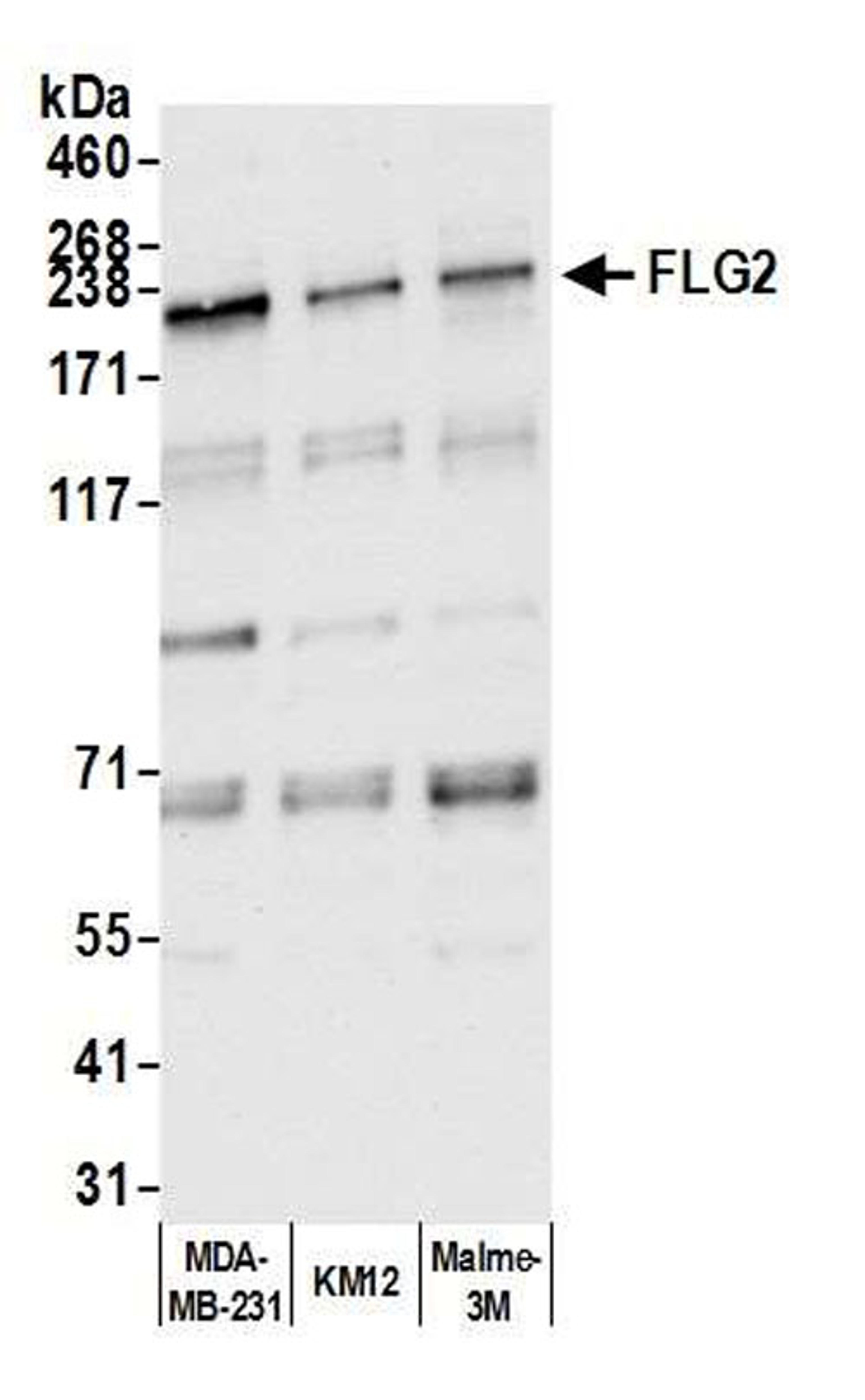 Detection of human FLG2 by WB.