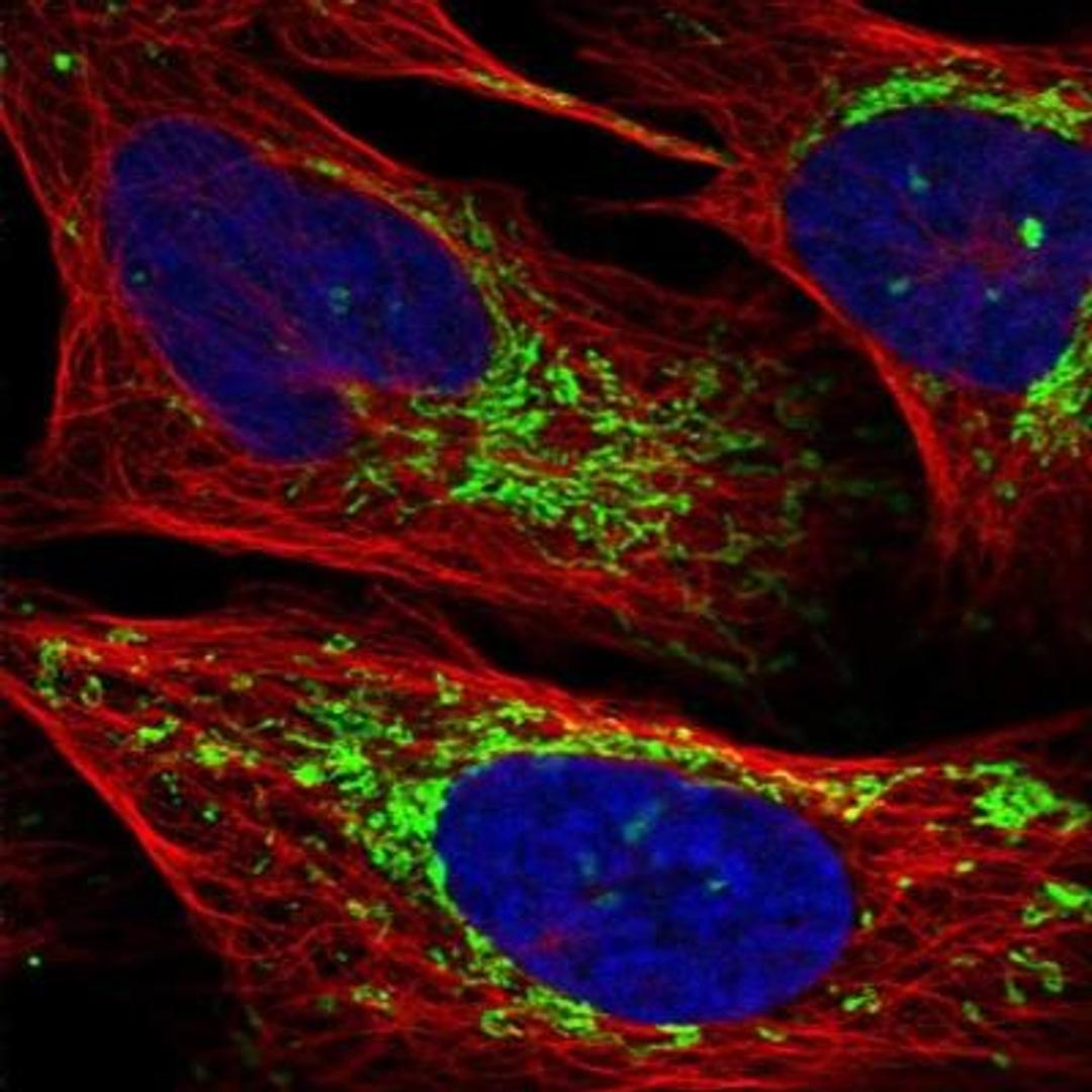 Immunocytochemistry: CHCHD2 Antibody [NBP1-94106] - Staining of human cell line U-2 OS shows positivity in mitochondria.