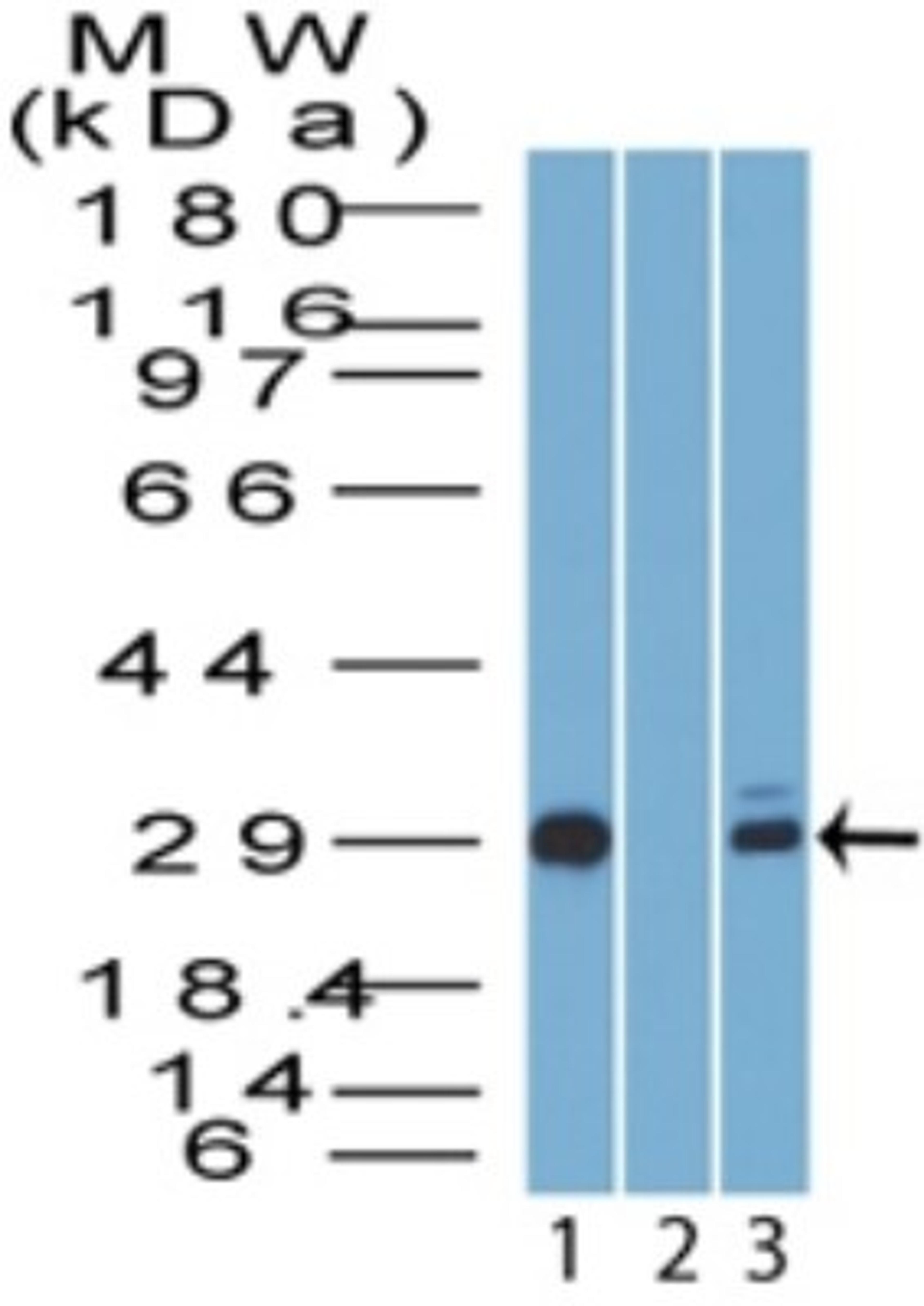 Western Blot: 14-3-3 sigma/Stratifin Antibody [NBP2-27072] - analysis of 14-3-3 sigma (248 amino acid isoform) using 14-3-3 sigma polyclonal antibody. Human A431 cell lysate in the 1) absence and 2) presence of immunizing peptide, and 3) HeLa cell lysate probed with 14-3-3 sigma antibody at 3 ug/ml.