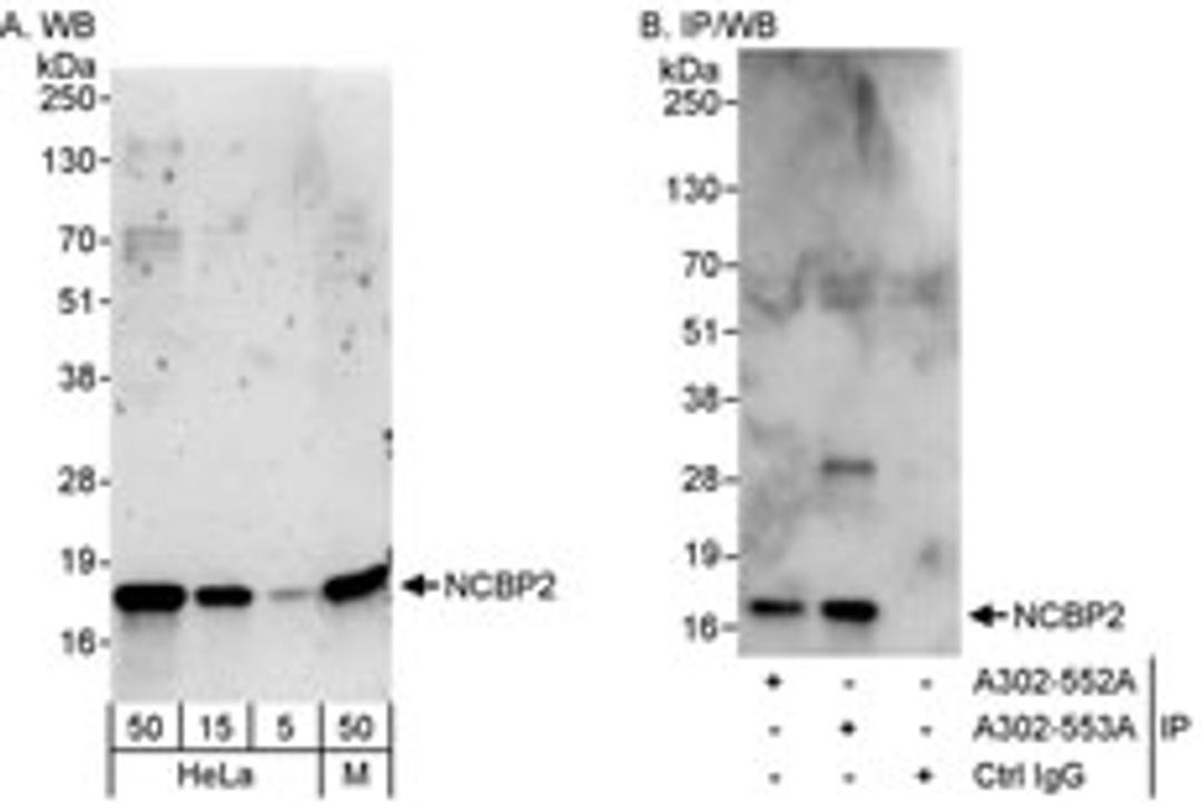 Detection of human and mouse NCBP2 by western blot (h&m) and immunoprecipitation (h).