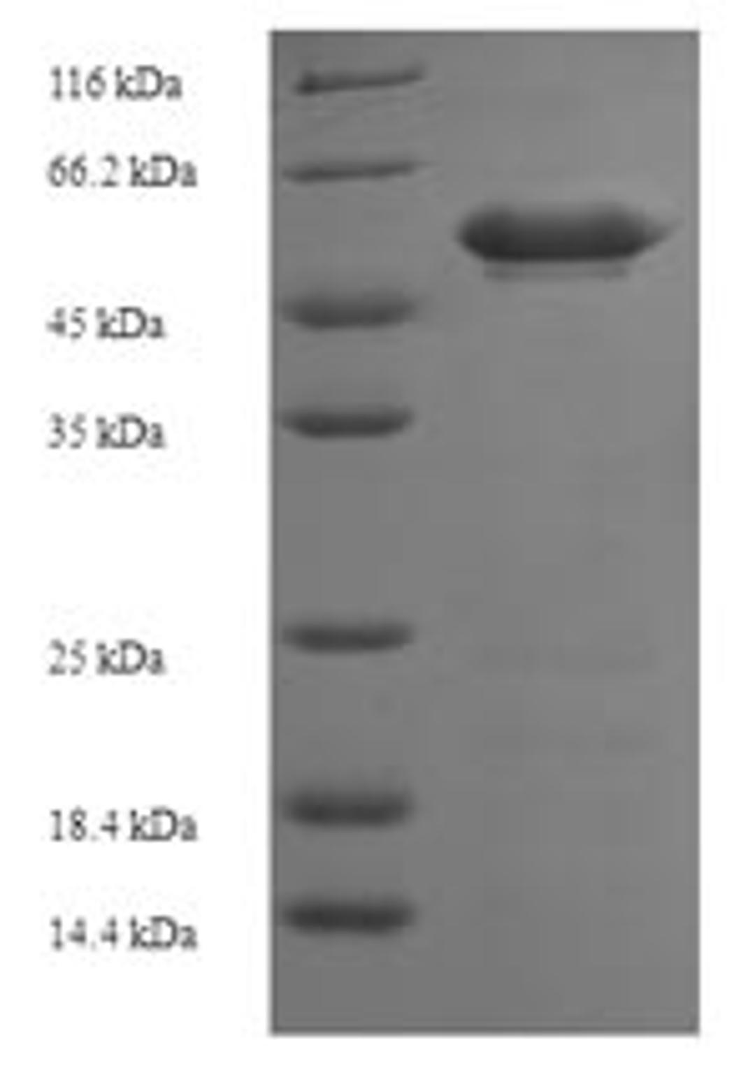 (Tris-Glycine gel) Discontinuous SDS-PAGE (reduced) with 5% enrichment gel and 15% separation gel.