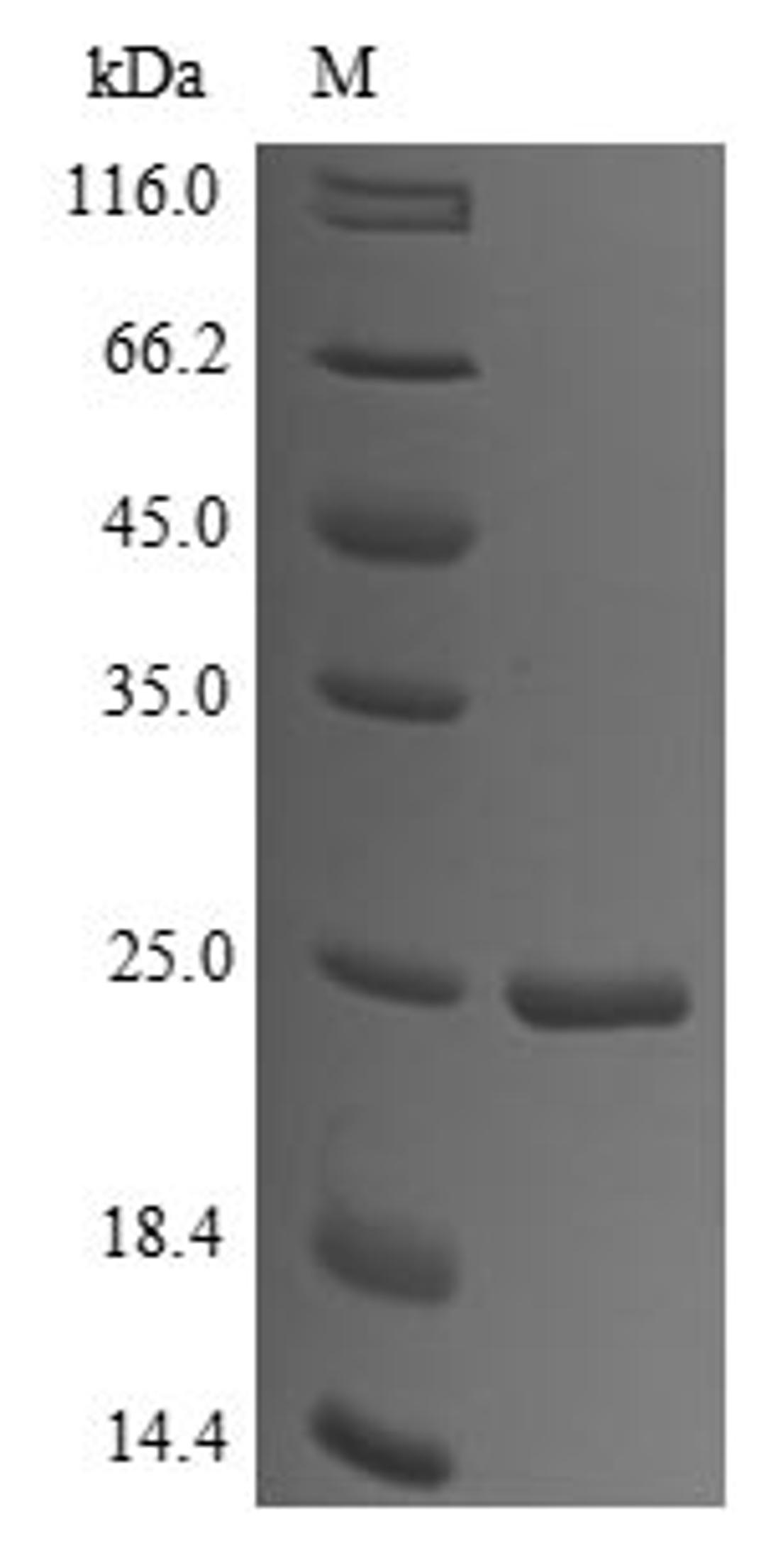 (Tris-Glycine gel) Discontinuous SDS-PAGE (reduced) with 5% enrichment gel and 15% separation gel.