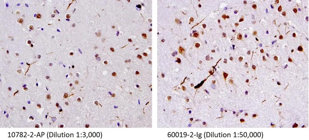 IHC staining of human brain (FTLD-U) tissue using 10782-2-AP