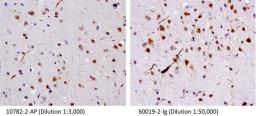 IHC staining of human brain (FTLD-U) tissue using 10782-2-AP