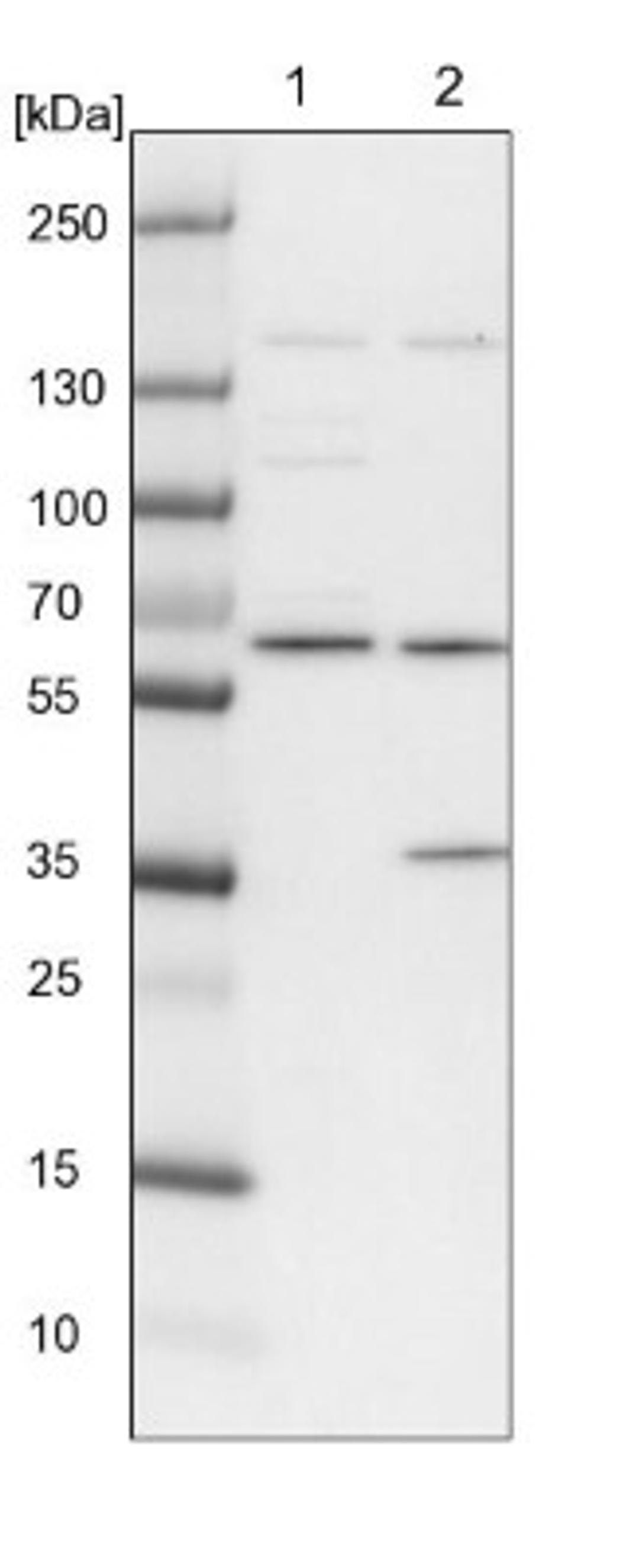 Western Blot: SPATA13 Antibody [NBP1-90848] - Lane 1: NIH-3T3 cell lysate (Mouse embryonic fibroblast cells)<br/>Lane 2: NBT-II cell lysate (Rat Wistar bladder tumour cells)