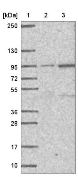 Western Blot: PIGN Antibody [NBP1-81248] - Lane 1: Marker [kDa] 250, 130, 95, 72, 55, 36, 28, 17, 10<br/>Lane 2: Negative control (vector only transfected HEK293T lysate)<br/>Lane 3: Over-expression lysate (Co-expressed with a C-terminal myc-DDK tag (~3.1 kDa) in mammalian HEK293T cells, LY406118)