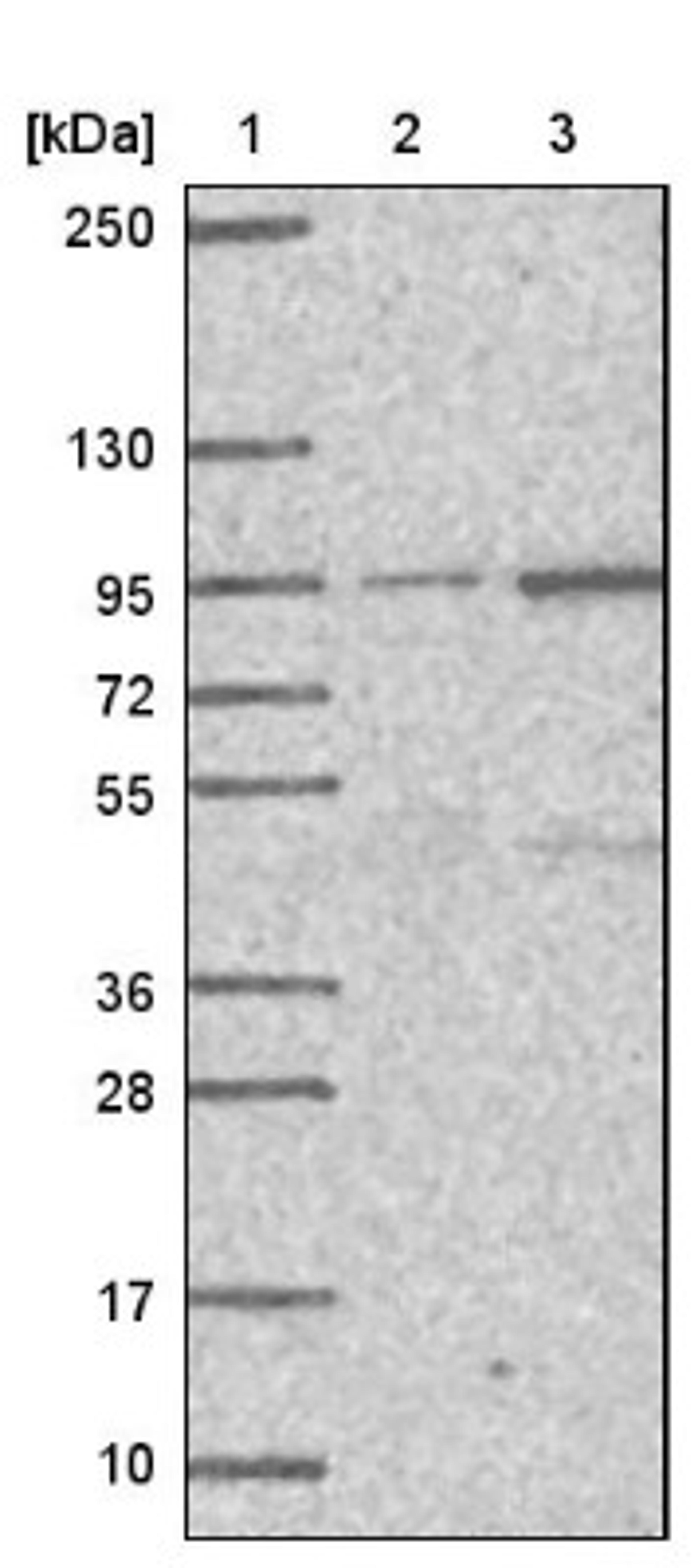 Western Blot: PIGN Antibody [NBP1-81248] - Lane 1: Marker [kDa] 250, 130, 95, 72, 55, 36, 28, 17, 10<br/>Lane 2: Negative control (vector only transfected HEK293T lysate)<br/>Lane 3: Over-expression lysate (Co-expressed with a C-terminal myc-DDK tag (~3.1 kDa) in mammalian HEK293T cells, LY406118)