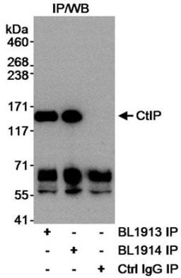 Detection of human CtIP by immunoprecipitation.