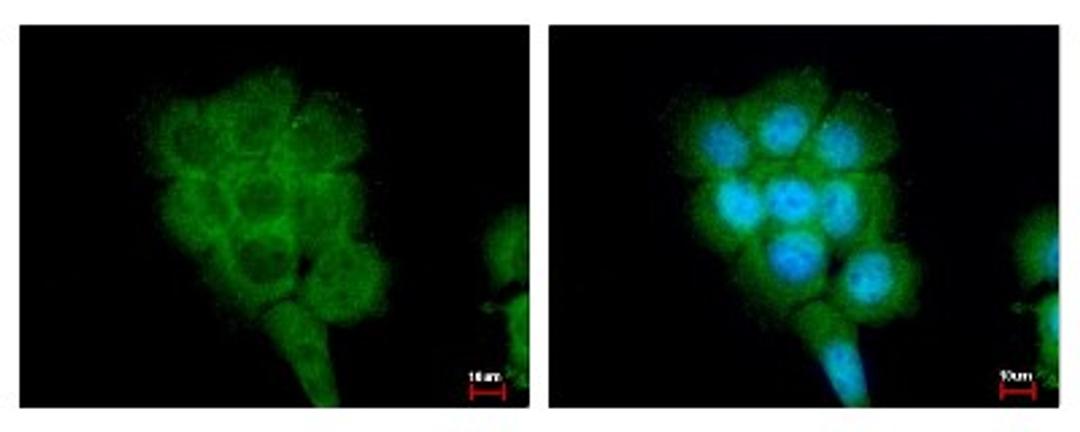 Immunocytochemistry/Immunofluorescence: FPGT Antibody [NBP2-16527] - A431 cells were fixed in 4% paraformaldehyde at RT for 15 min. Green: FPGT protein stained by FPGT antibody diluted at 1:500. Blue: Hoechst 33342 staining.