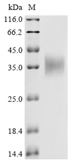 (Tris-Glycine gel) Discontinuous SDS-PAGE (reduced) with 5% enrichment gel and 15% separation gel.