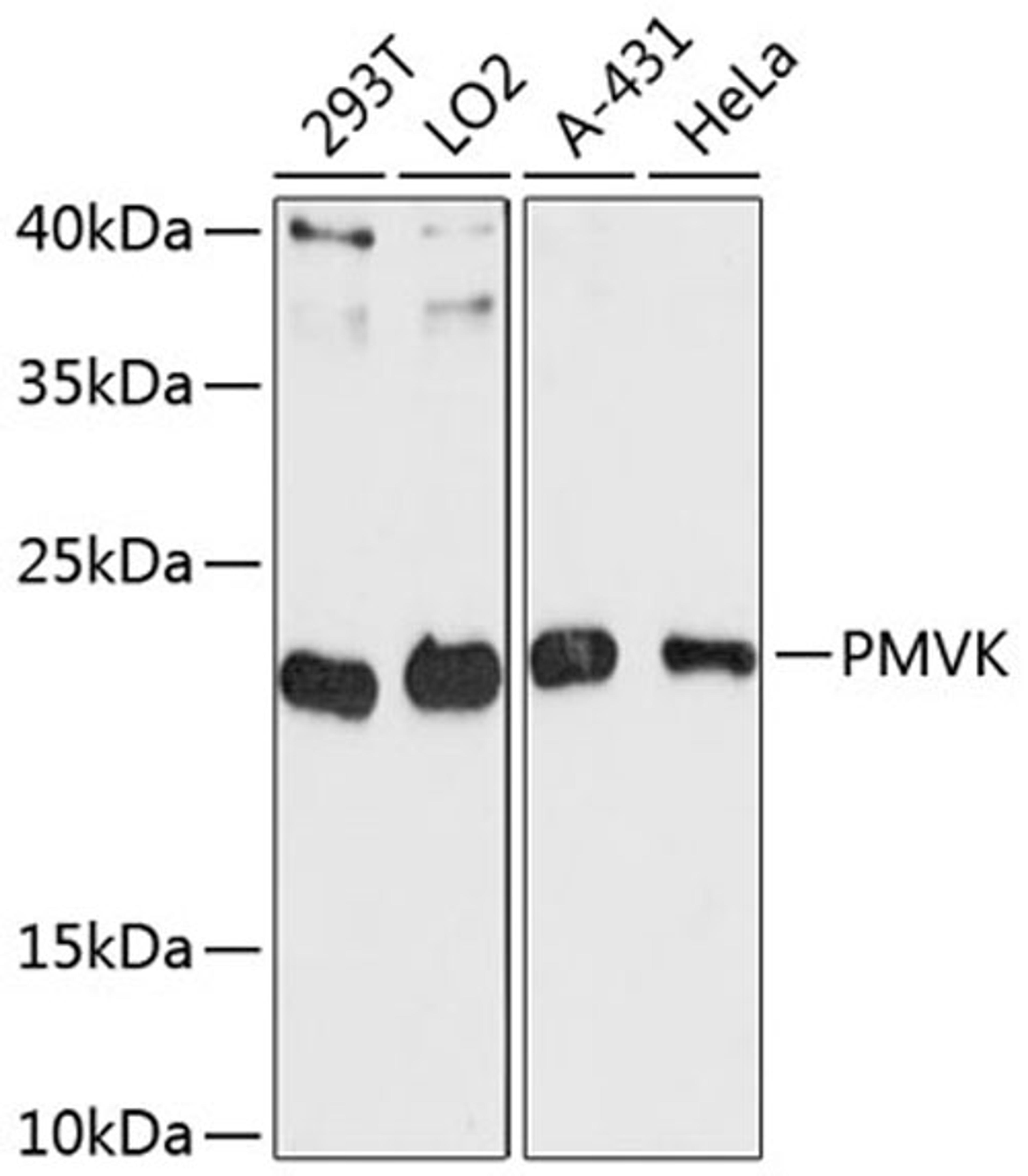 Western blot - PMVK antibody (A13866)