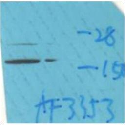 Western blot analysis of HeLa whole cell lysates using Calmodulin -Phospho-Thr79+Ser81- antibody