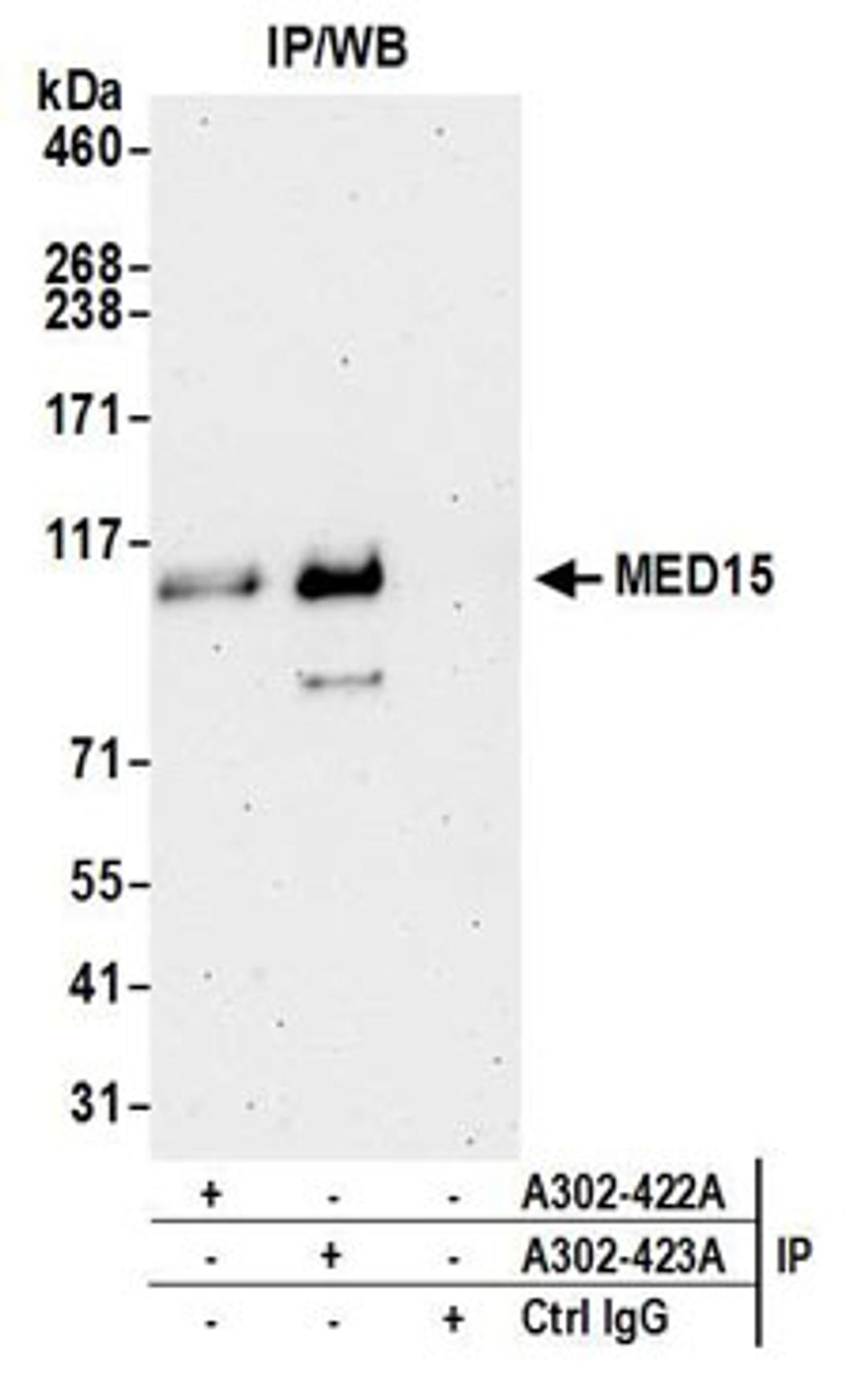 Detection of human MED15 by western blot of immunoprecipitates.