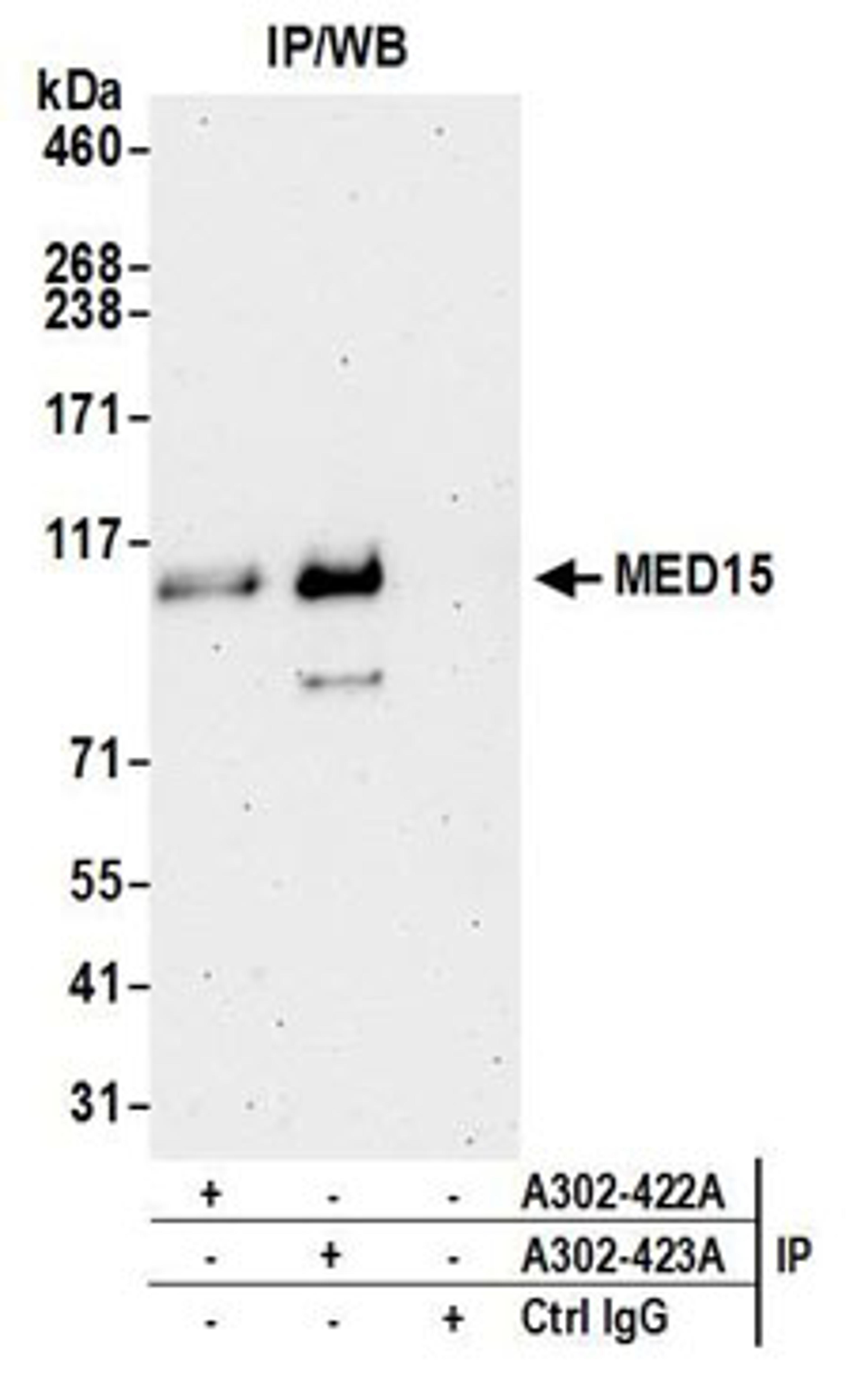 Detection of human MED15 by western blot of immunoprecipitates.