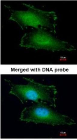 Immunocytochemistry/Immunofluorescence: Peflin Antibody [NBP1-31613] - Paraformaldehyde-fixed HeLa, using antibody at 1:200 dilution.