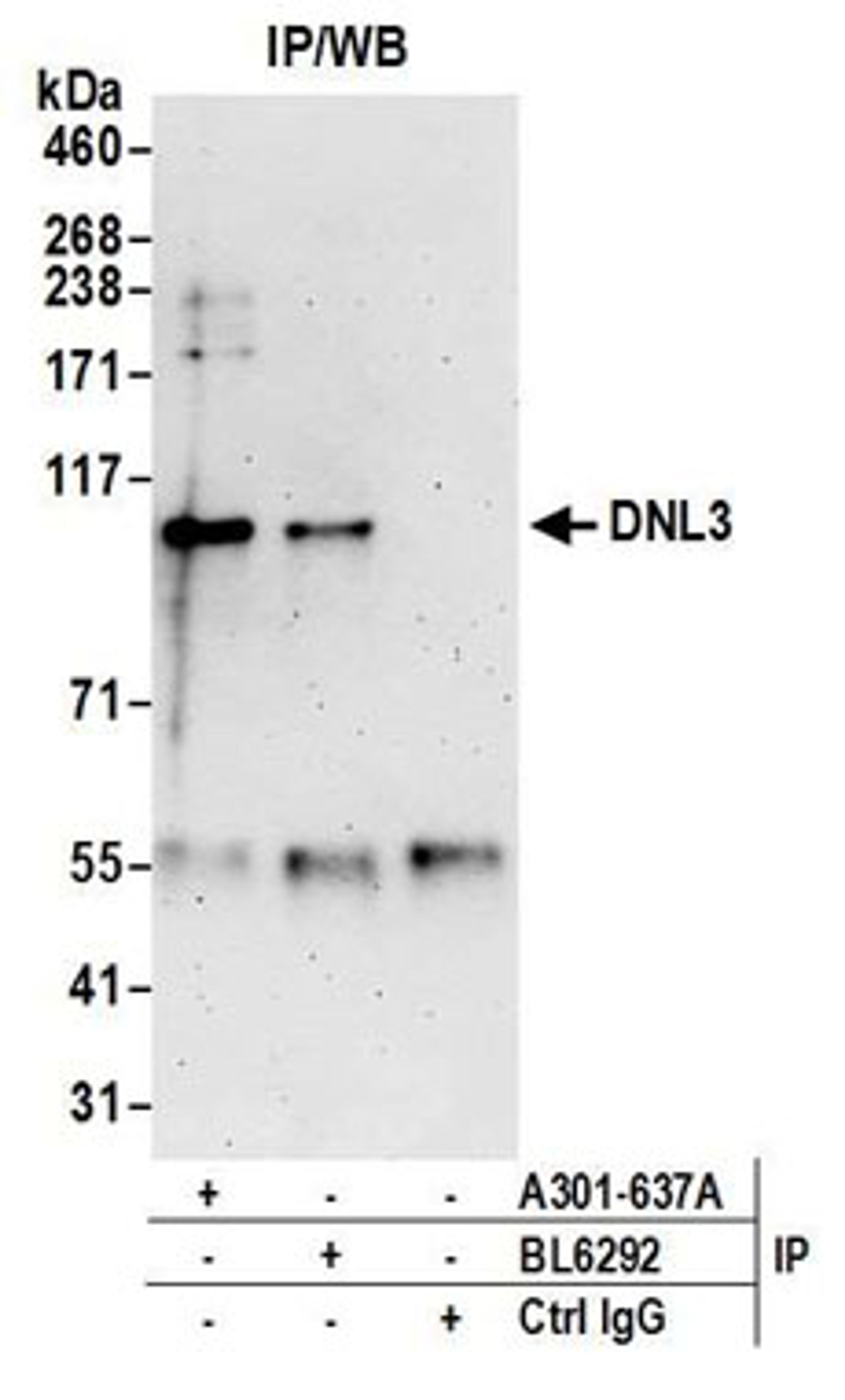 Detection of human DNL3 by western blot of immunoprecipitates.