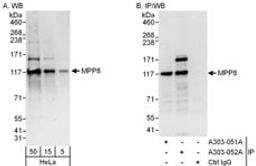 Detection of human MPP8 by western blot and immunoprecipitation.