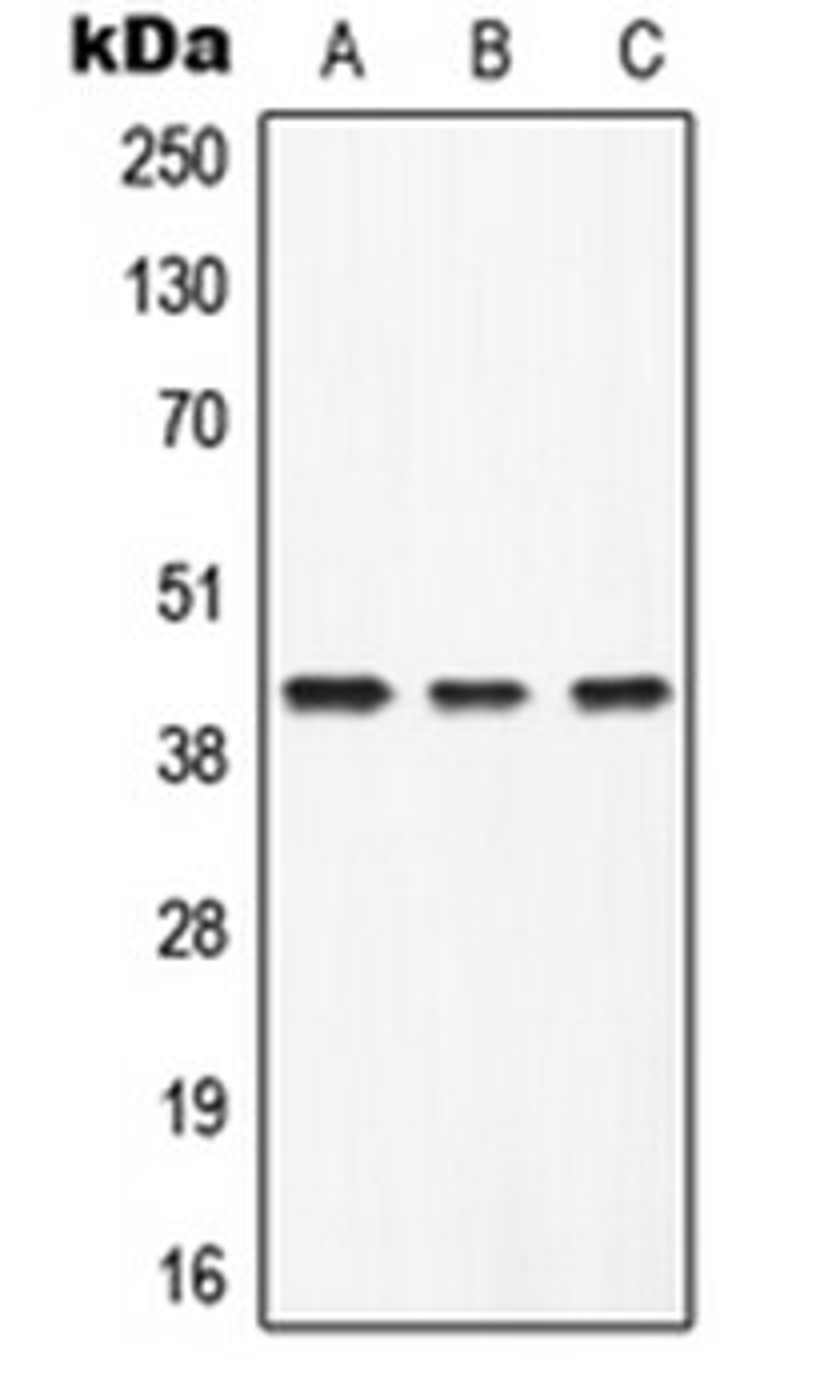 Western blot analysis of Human liver (Lane 1), mouse heart (Lane 2), rat heart (Lane 3) whole cell lysates using AZGP1 antibody