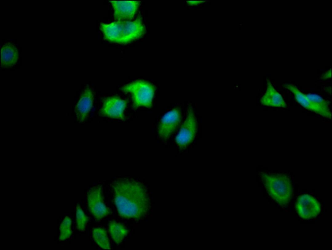 Immunofluorescence staining of Hela Cells with CSB-RA240595A0HU at 1:50, counter-stained with DAPI. The cells were fixed in 4% formaldehyde, permeated by 0.2% TritonX-100, and blocked in 10% normal Goat Serum. The cells were then incubated with the antibody overnight at 4℃. Nuclear DNA was labeled in blue with DAPI. The secondary antibody was FITC-conjugated AffiniPure Goat Anti-Rabbit IgG (H+L).
